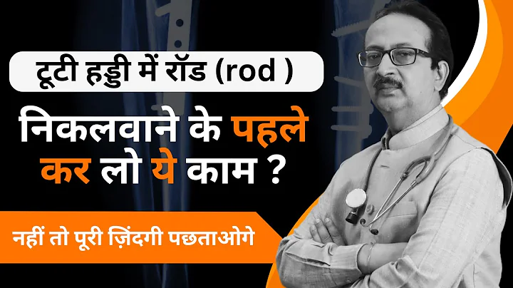 टूटे हड्डियों में रॉड rod  Plate ,Wire ,Screws लगी हो तो जाने उन्हें कब निकलवाएँ ? | bone fractured