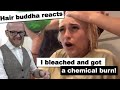 She Bleached and got chemical burns - Hairdresser reacts - Hair Buddha