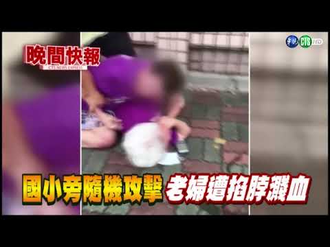 【晚間搶先報】遭壯男勒脖攻擊 晨運婦人頭部受傷