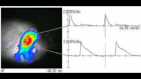 High Speed Imaging of Atrial and Ventricular Action Potential