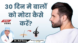 क्या 30 दिनों मे Thick Hair हो सकता है ? |  How Can I Get Thick Hair a Month? | Dr. Anil Garg