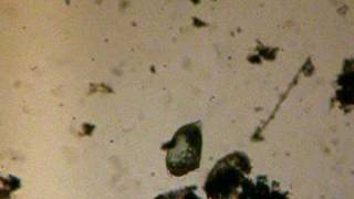 Stentor sp. (Fam. Stentoridae; F. Ciliophora) 1 (telotrocho)