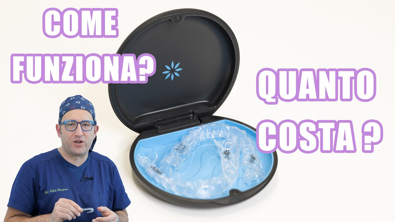 Invisalign: come funziona e quanto costa l'apparecchio invisibile?