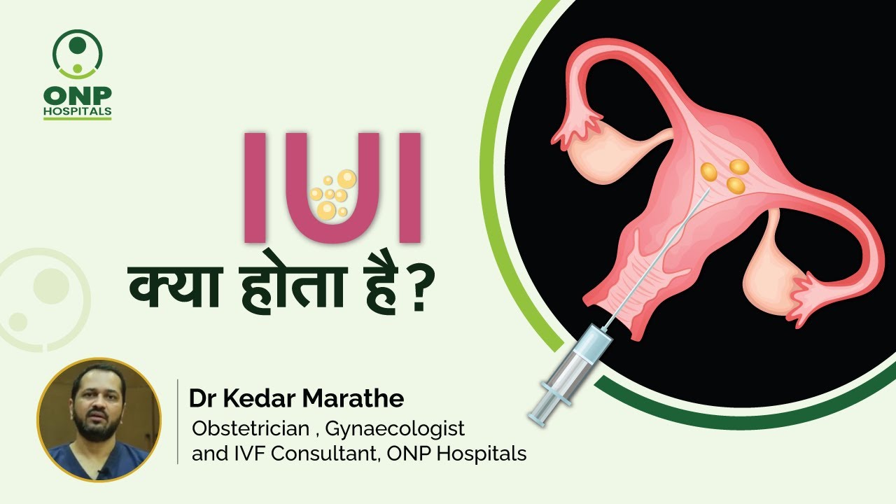 IUI क्या होता है ?|  IUI प्रक्रिया कैसे की जाती है?|  IUI in Hindi | Dr. Kedar Marathe, ONP Hospital