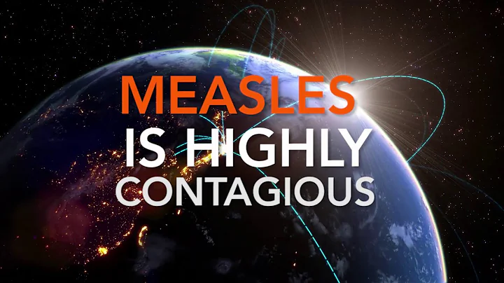 Measles Outbreak 2019