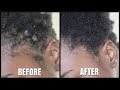 How To Easily Remove Build Up From Faux Locs and Braids