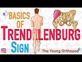 Trendelenburg's Test | ANIMATION | BASICS | The Young Orthopod | Trendelenberg Sign