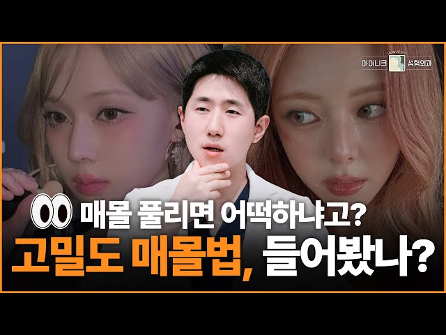 “이걸 모르고 매몰쌍꺼풀 했다고요? 쌍수 전 필수 시청!”│아이니크성형외과│차지환원장님