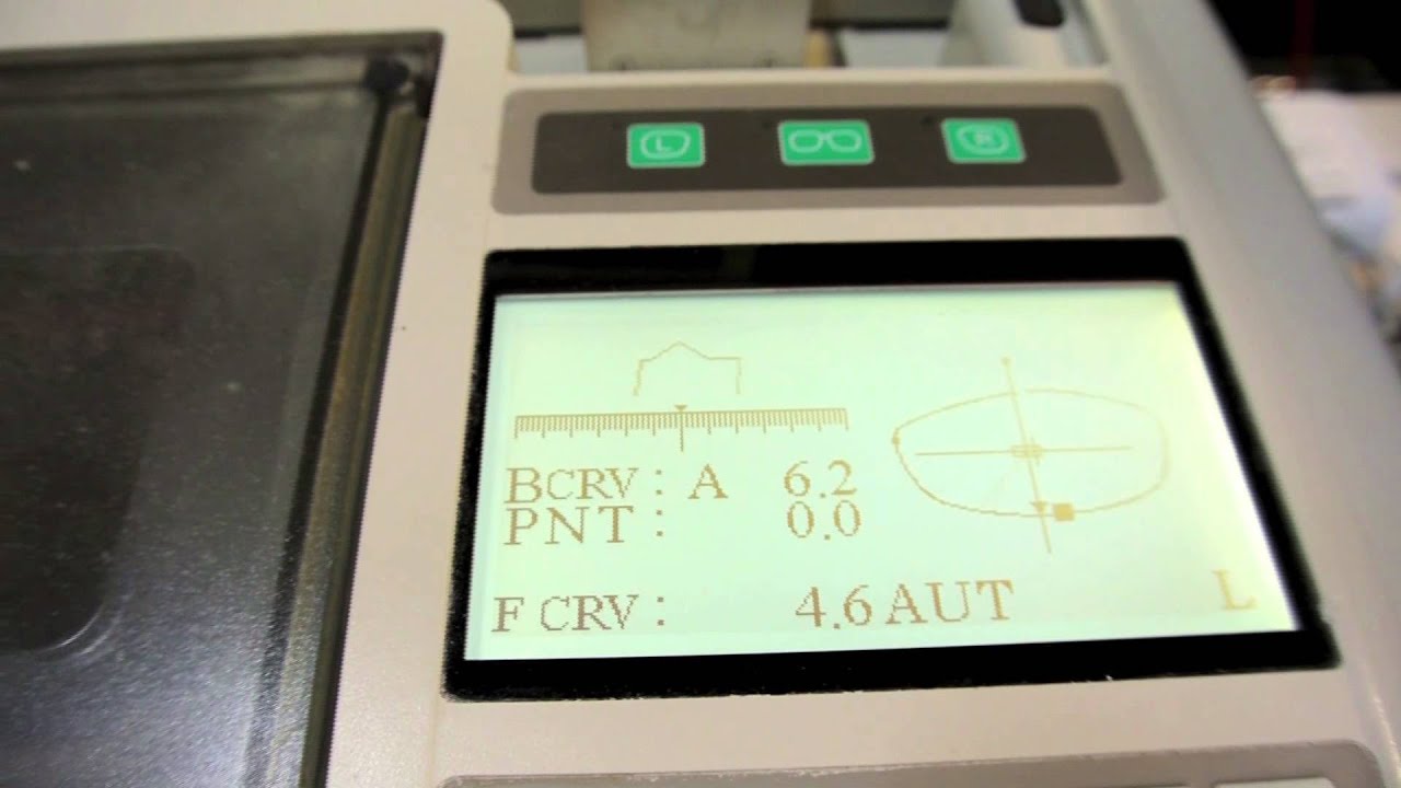 Santinelli Nidek LE-9000 SX Express for sale with only 10,300 cuts