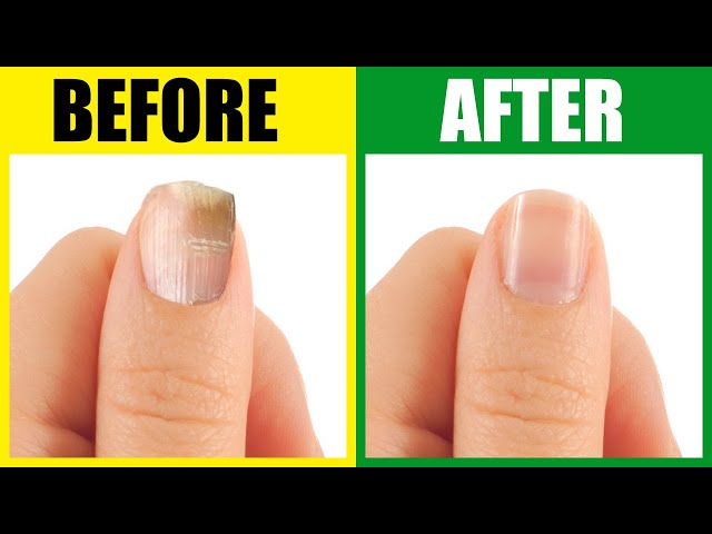 Well Being: Home Remedies for Nail Growth | DZ Breaking