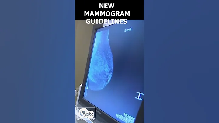 New guidelines recommend mammograms for women starting at age 40