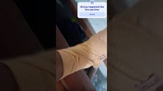 #by cutecloud #my leg broked
