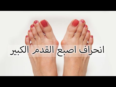 فيديو: ما الذي يسبب أكبر انحراف؟