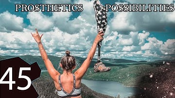 Prosthetics possibilities 45 | Prosthetic leg | Prosthetic arm | Cyborgs World