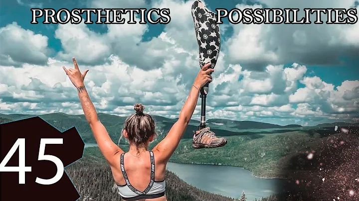 Prosthetics possibilities 45 | Prosthetic leg | Prosthetic arm | Cyborgs World