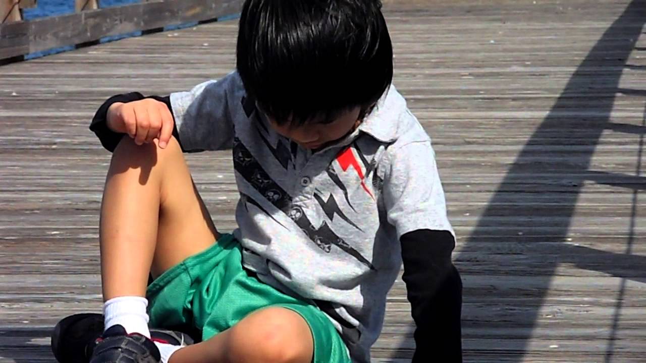 What Is Head Drop Seizures