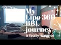 It Finally Happened | BBL Journey | The Process | Vlog #8