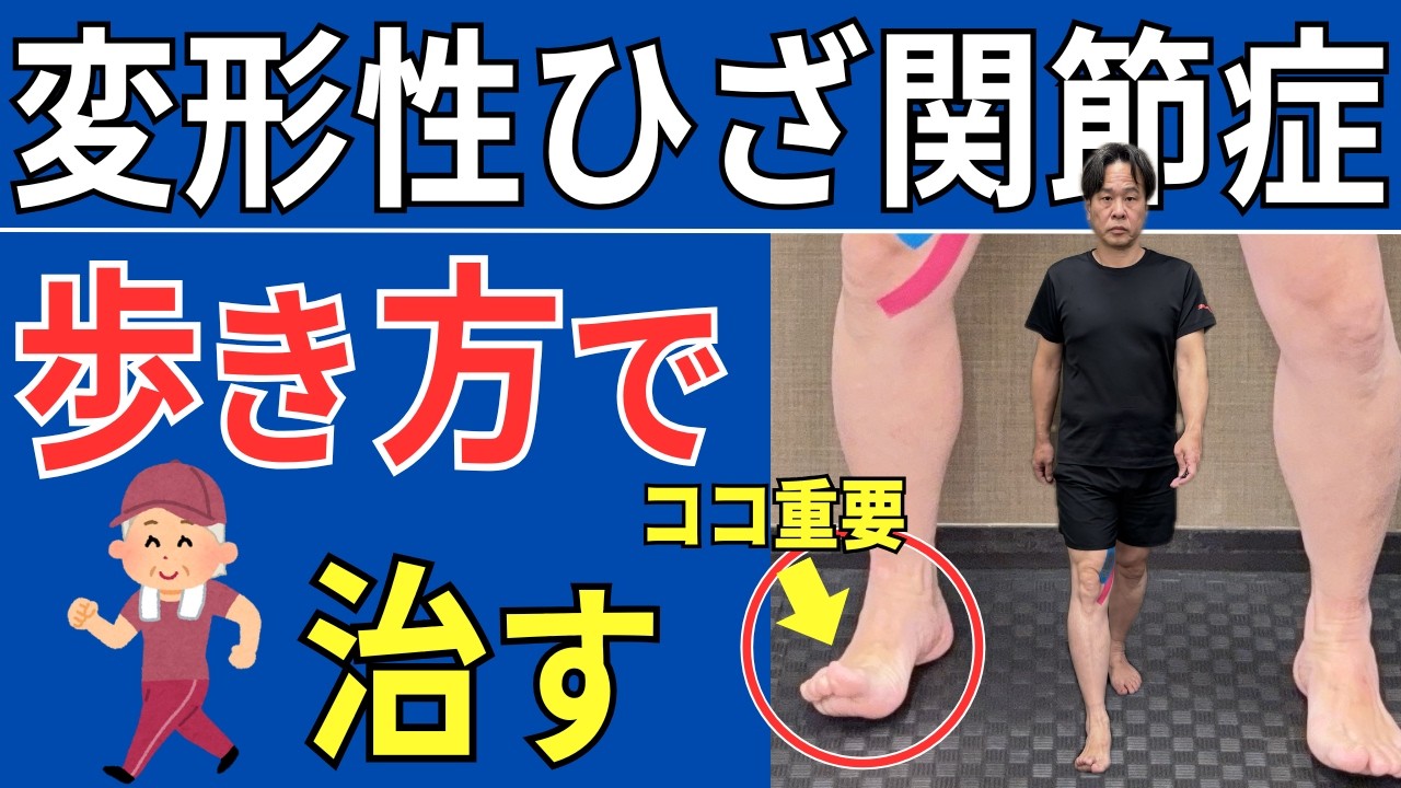 【変形性ひざ関節症】痛くならない歩き方 重要な2つのポイント  |  大阪市都島区 さかとう整骨院#100