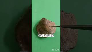 #Anatomy shorts #Patella BoneSideDetdetermination# #Anatomy trick #Viva prep #ReelsEducation