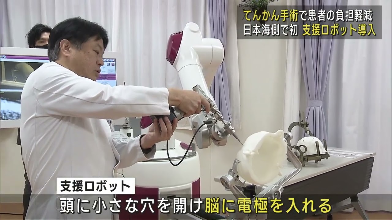 てんかんの手術 頭に開ける穴を小さく 支援ロボットで患者の負担軽減