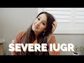 TWIN GROWTH COMPLICATIONS | SEVERE IUGR DIAGNOSIS week 22 | heather fern