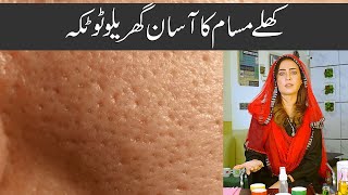 Dr Umme Raheel   OPEN PORES TREATMENT screenshot 5