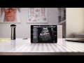 Asus lu700 portable ultrasound series fast and reliable medical imaging