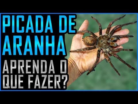 Vídeo: Como Identificar, Tratar E Sobreviver A Uma Picada De Aranha