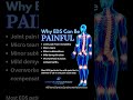 Why EDS Can Be Painful Shorts 