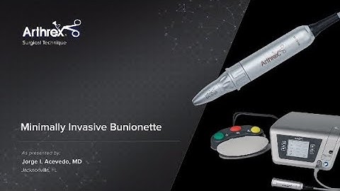 Minimally Invasive Bunionette
