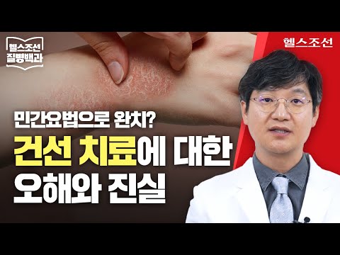 [건선] 난치 질환으로 알려진 건선, 의학적 치료로 충분히 극복 가능해