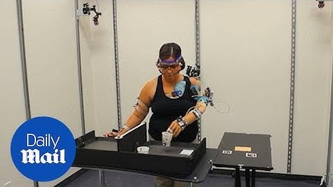 Scientists create prosthetic bionic arm that enables amputees to feel