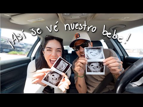 OUR FIRST ULTRASOUND!