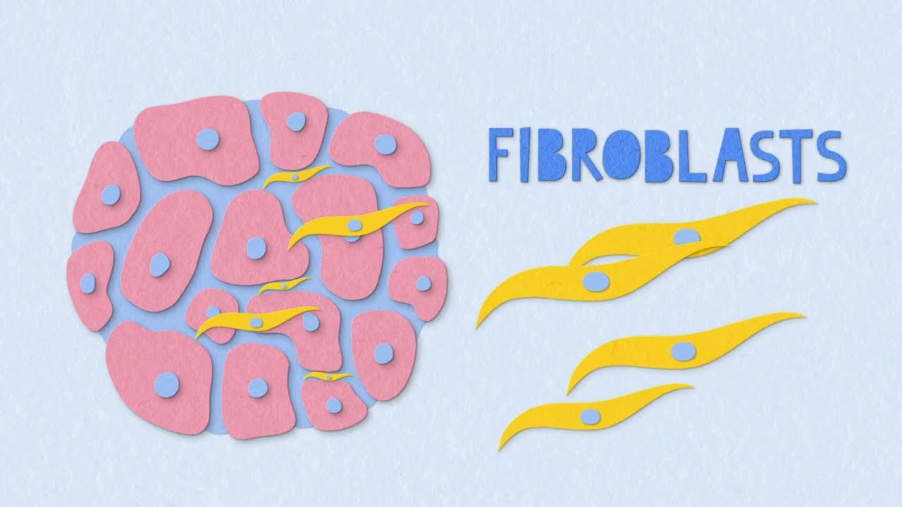 Fibrosis Explainer