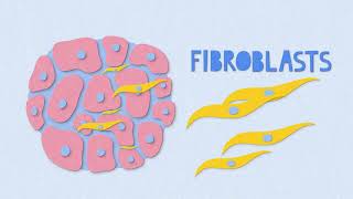 Fibrosis Explainer