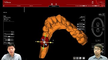 Step 6 EZ Wax Up (R2Gate Series)