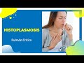 Histoplasmosis Pulmonar