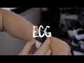 ECG no Apple Watch Series 4