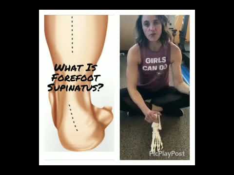 What is forefoot supinatus