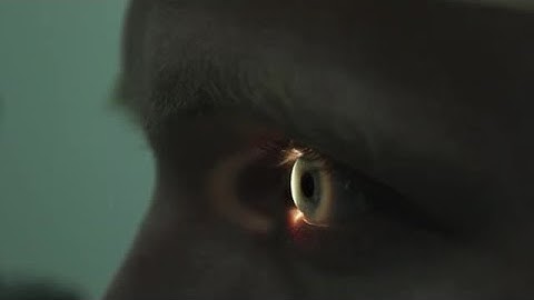 Retinal Scan Of A Young Man