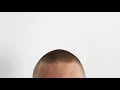 Pros & Cons of a Shaved Head