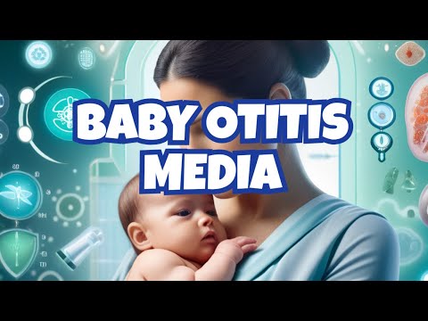 Video: Otitis Media In Children - Symptoms, Treatment, Prevention, Causes, Signs