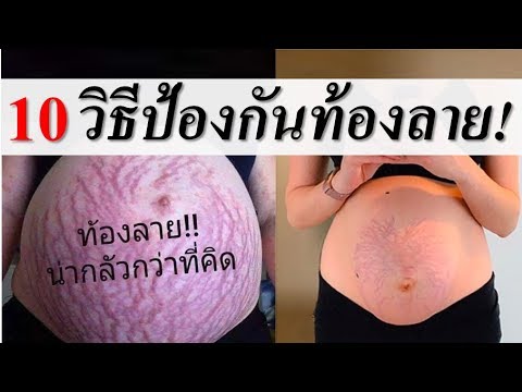 ท้อง ลาย ตั้ง ครรภ์  New 2022  รอยแตกลาย : 10 วิธีป้องกันผิวแตกลาย ท้องลาย | การดูแลคนท้อง | คนท้อง Everything