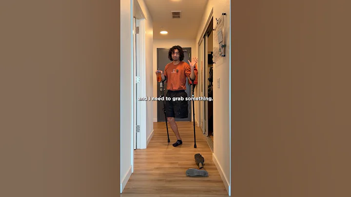 What happens if I don’t have my Prosthetic Leg?!