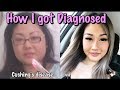 How I got Diagnosed