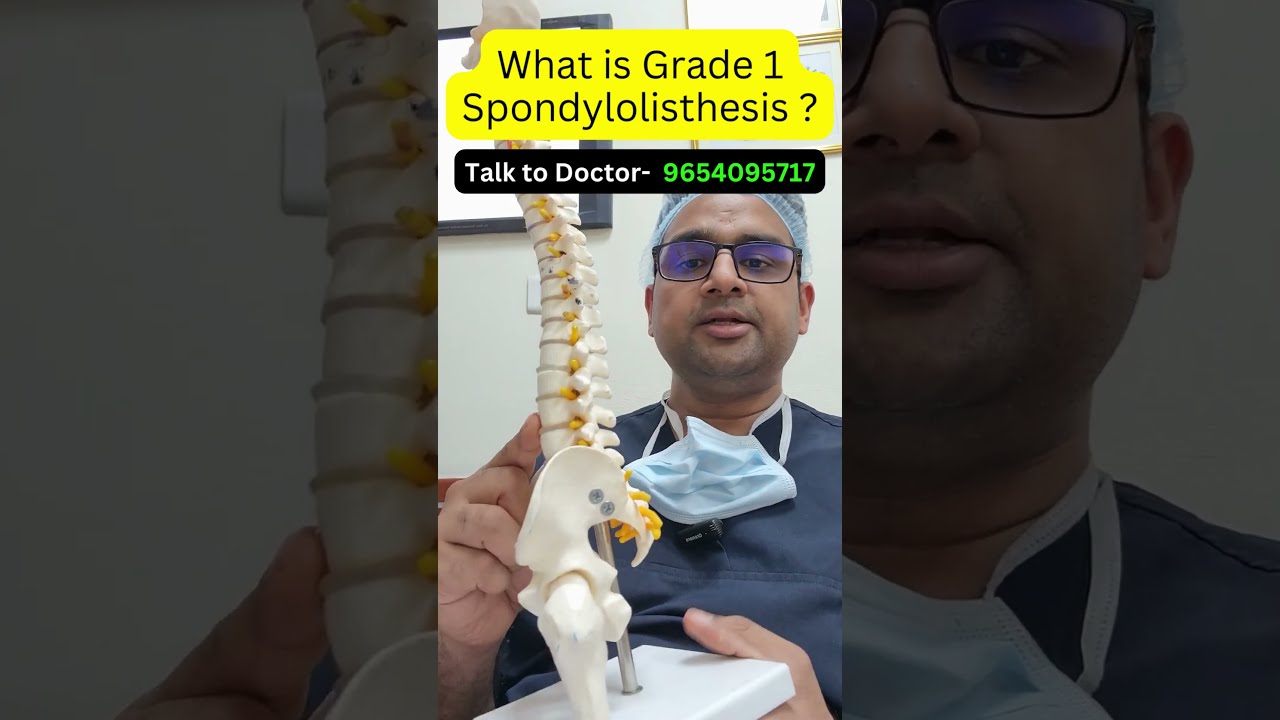 What Is Grade 1 Spondylolisthesis Shorts viral shortsvideo noida What Is Grade 1 Spondylolisthesis Shorts viral shortsvideo noida