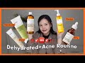 Dehydrated acneprone stop using acne skincare  ft new manyo  hikoco