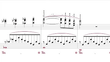 Slur/Articulation Interaction in Finale v26