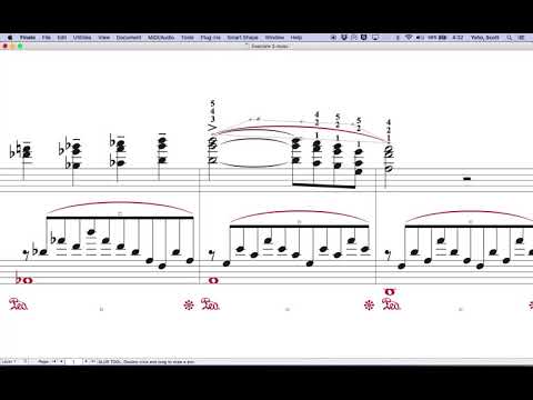 Slur/Articulation Interaction in Finale v26