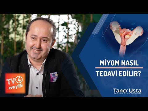 Miyom Nasıl Tedavi Edilir?